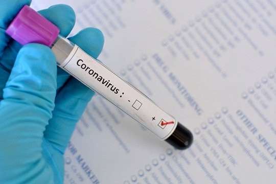 Ризик значного поширення коронавірусу за межі Китаю дуже низький - дослідження