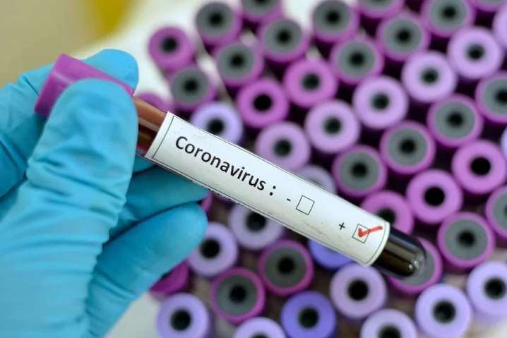 У Чернівецькій області зафіксували два нові випадки зараження коронавірусом