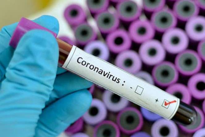 Пандемія коронавірусу: кількість хворих перевищила 380 тисяч