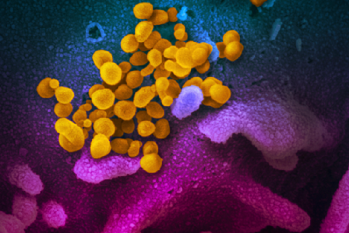 «Матове скло»: у людей, які безсимптомно хворіли коронавірусом, виявили ураження легень