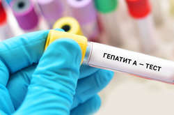 Спалах гепатиту в дитячому будинку на Одещині: лікарі назвали ймовірне джерело зараження