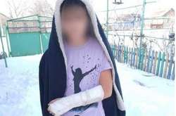 Скандал у школі на Одещині: учениця зламала руку, а їй не надали допомоги (фото)