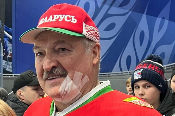 Лукашенко до крови разбили лицо во время хоккейного матча (видео)