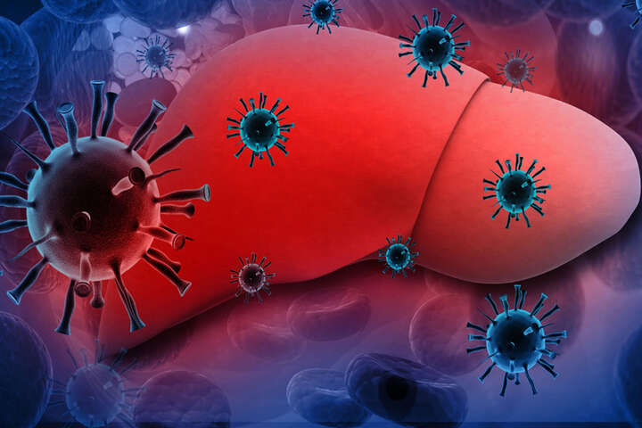 Світом шириться гепатит невідомого походження: де його вже виявили