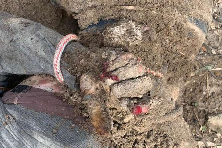 Під Києвом знайдено тіла закатованих окупантами жителів із зірваними нігтями (фото)