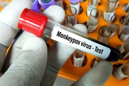 Учені встановили походження вірусу мавпячої віспи – ЗМІ