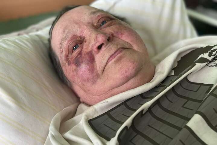 Россияне жестоко избили 70-летнюю волонтерку из Херсона (фото)