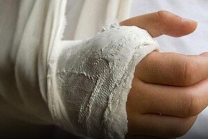 На Житомирщині мати зламала синові руку через різні політичні погляди