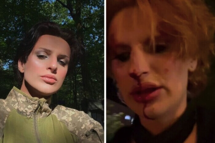 Избиение трансгендерной военной во Львове. Омбудсмен отреагировал