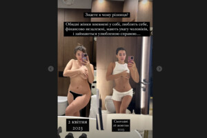 «Міс Україна Всесвіт» до та після схуднення: приголомшливі фото