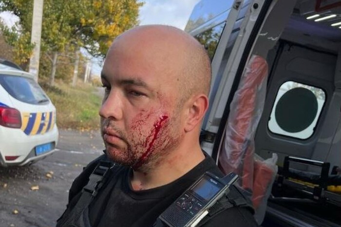 На Дніпропетровщині чоловік із ножем напав на поліцейських