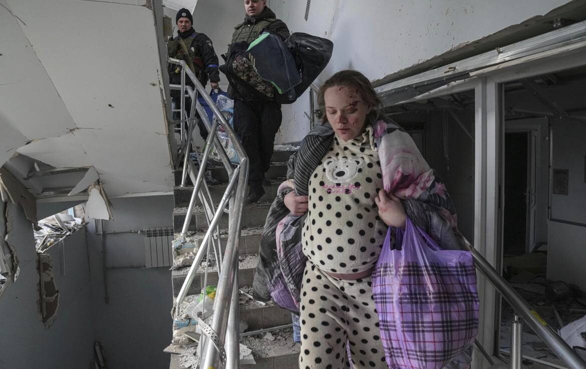 Українка, яка вижила після обстрілу пологового будинку в Маріуполі, публічно підтримала Путіна