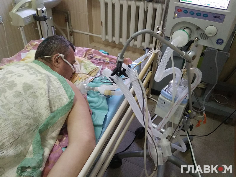 Хворий з Шепетівки, який був підключений до апарату ШВЛ 42 дні. Фото надано лікарем